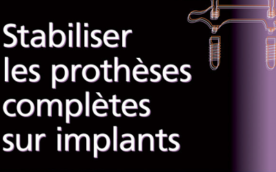 Recommandation : « Stabiliser les prothèses complètes sur implants »