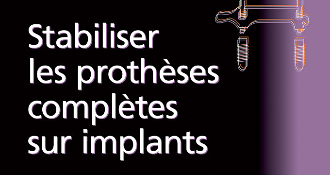 Recommandation : « Stabiliser les prothèses complètes sur implants »