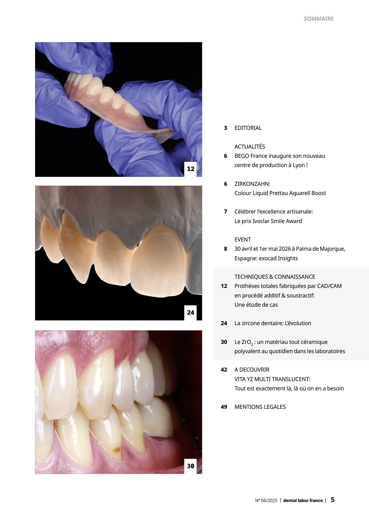 Dental Labor france 6/2025 Editionintégrale dl-france-inhalt-5.2025